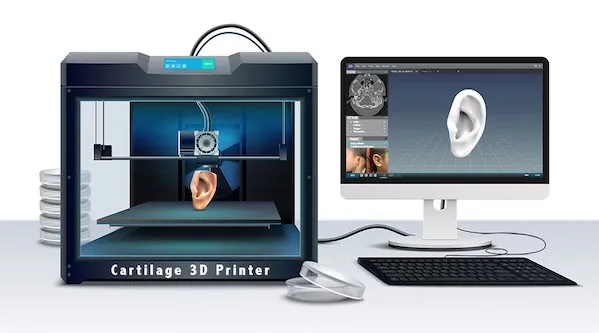 Illustration of a cartilage 3D bioprinter producing an ear framework for microtia reconstruction, with a computer monitor showing the 3D ear model — Dr. Arturo Bonilla