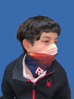 Resultado postoperatorio: paciente 16 después de la reconstrucción auricular con cartílago costal natural realizada por el Dr. Arturo Bonilla