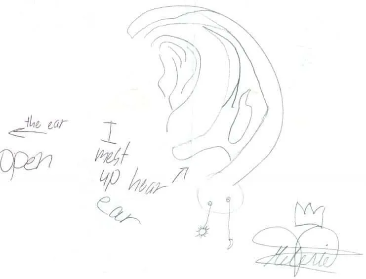 Boceto detallado a lápiz de una oreja humana con el rótulo en inglés «the ear open I melt up hear ear», firmado por una paciente llamada Valeria con un corazón coronado: un regalo personal y simbólico de agradecimiento al Dr. Arturo Bonilla de una paciente agradecida que se sometió a cirugía de microtia