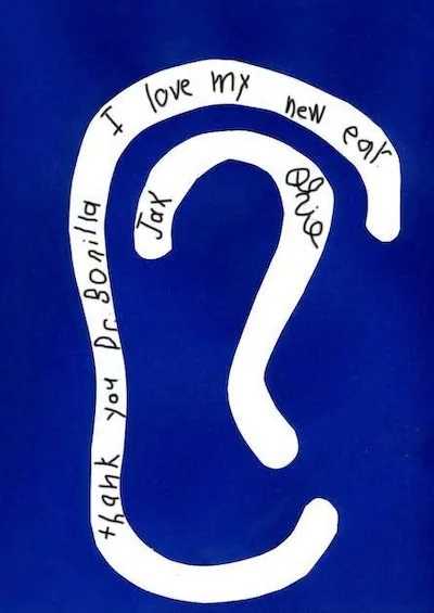 Handwritten thank you letter from a microtia patient family to Dr. Bonilla