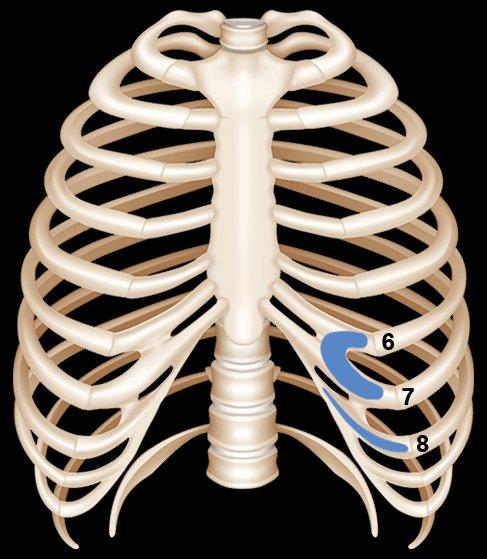 Diagram showing rib cartilage harvest site used in microtia ear reconstruction surgery — costal cartilage donor location